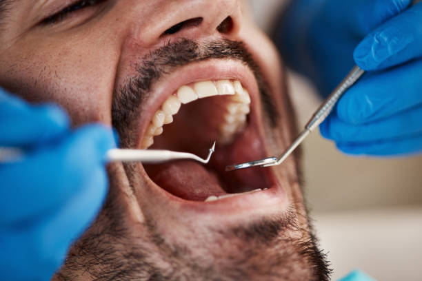 Best Broken or Cracked Tooth Emergency Dentist in La Habra Heights, CA